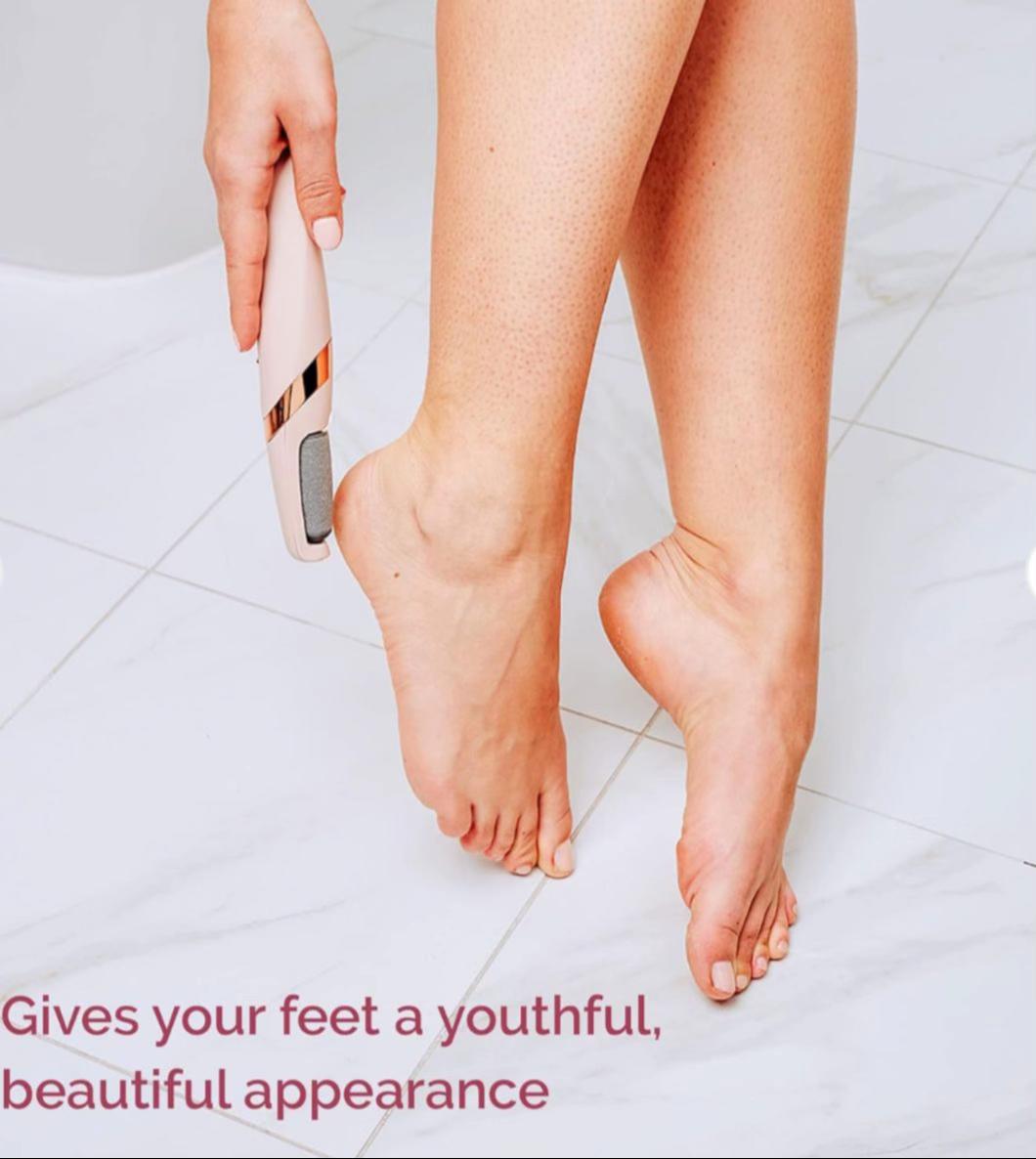 fit callus remover